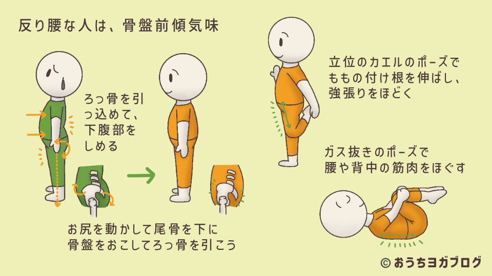 イラスト図解・反り腰な山のポーズと修正方法